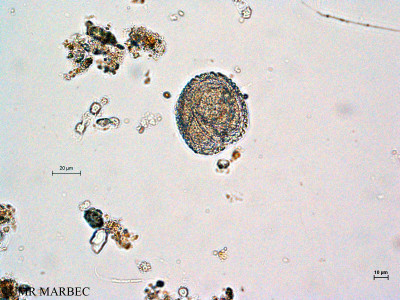 phyto/Thau_Lagoon/THAU_station1/GELAMED 2010/Protoperidinium thorianum(copy)_thumb.jpg